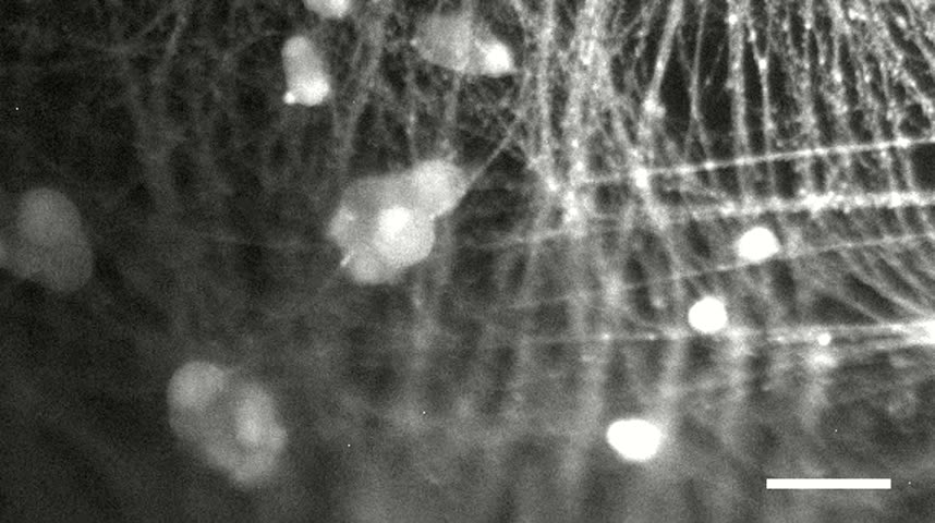 Live microscopy of real neurons extending axons and wiring together.